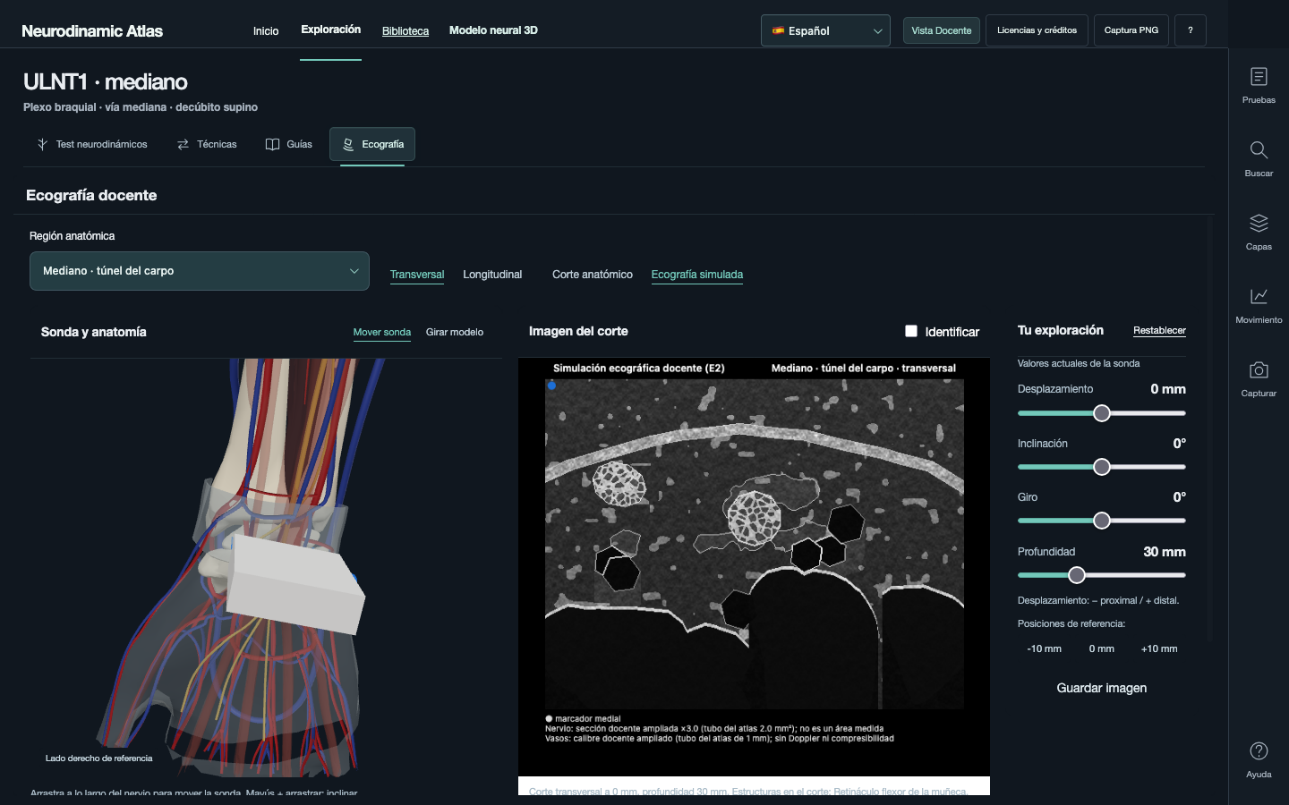 Abrir ecografía y modelo 3D