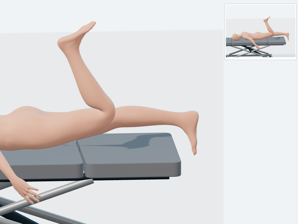 FEMORAL — PKB / FLEXIÓN DE RODILLA EN PRONO: posición final