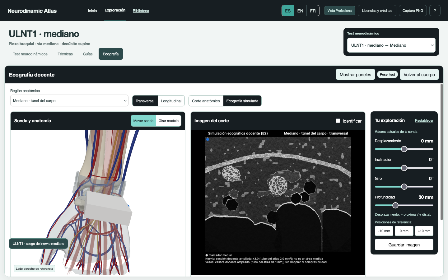 Abrir ecografía y modelo 3D