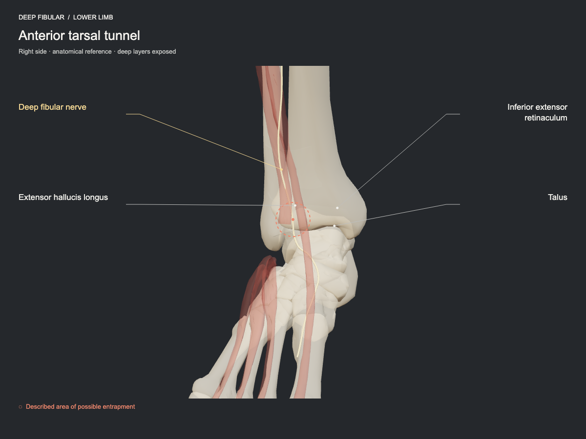 Anterior tarsal tunnel