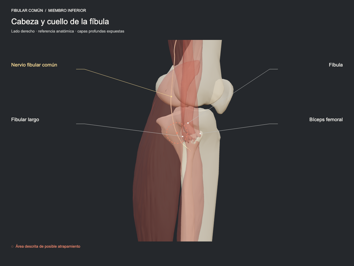 Cabeza y cuello de la fíbula
