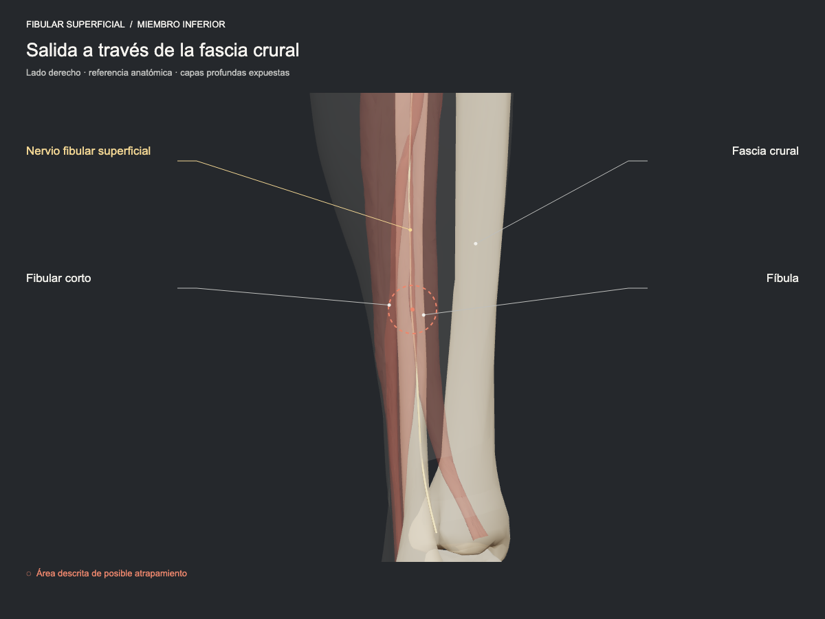 Salida a través de la fascia crural