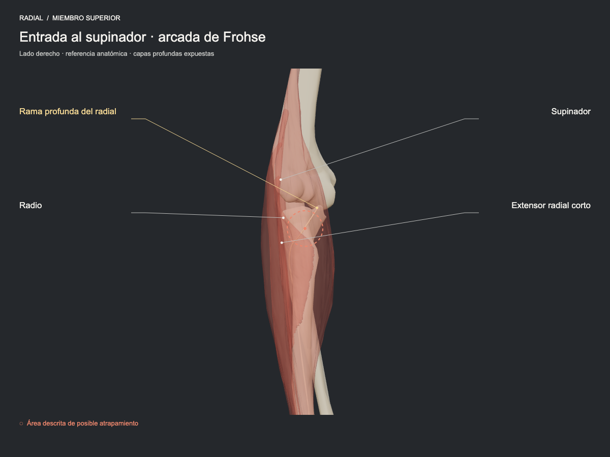 Entrada al supinador · arcada de Frohse