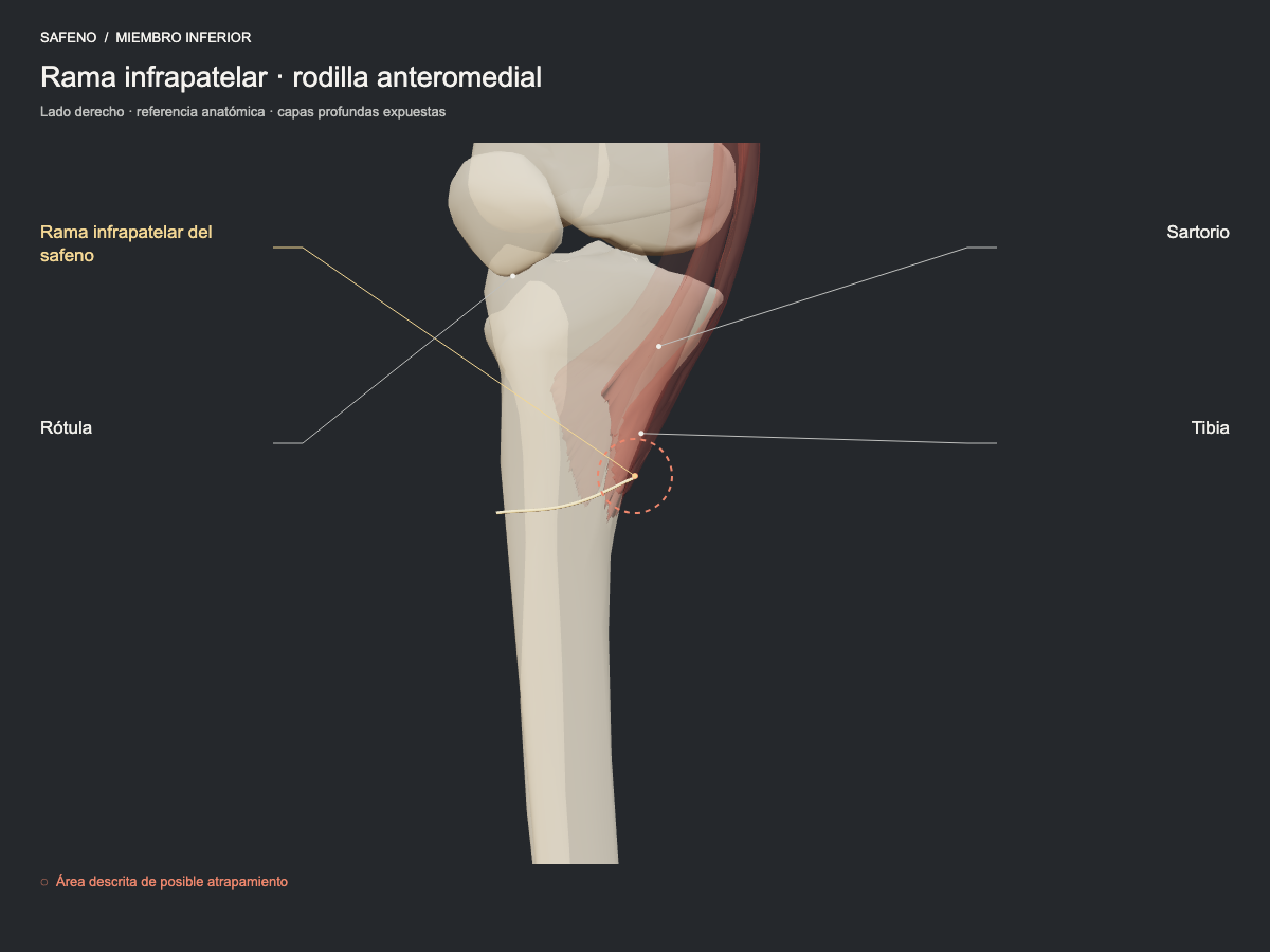 Rama infrapatelar · rodilla anteromedial