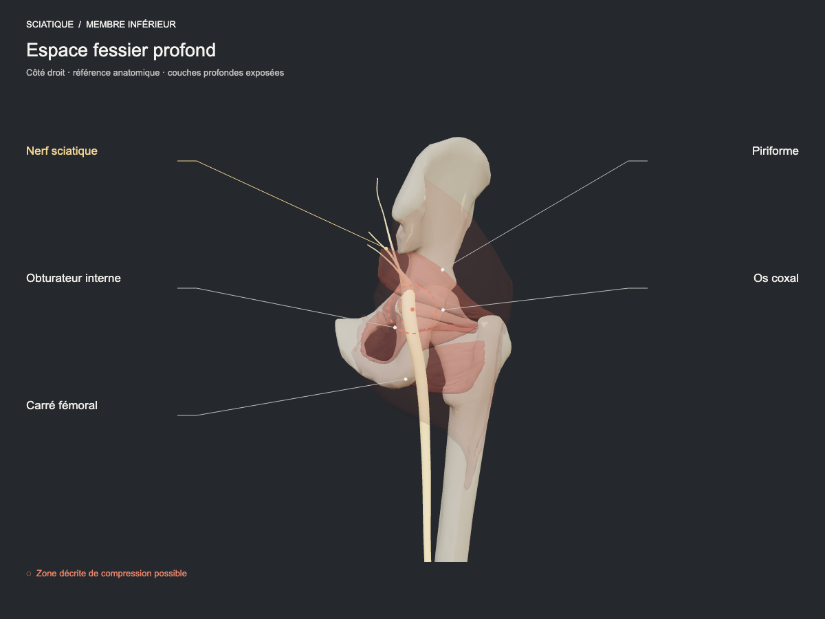 Espace fessier profond