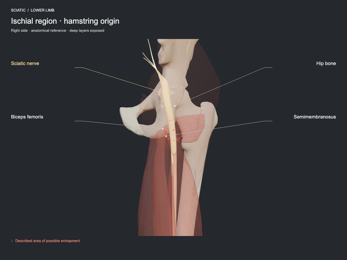 Ischial region · hamstring origin