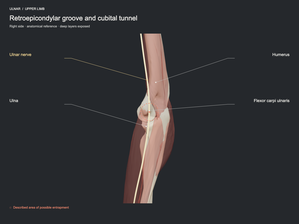 Retroepicondylar groove and cubital tunnel