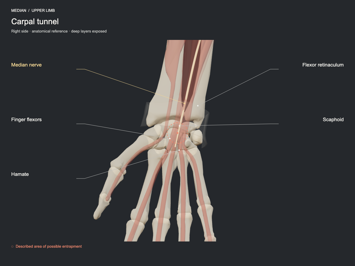 Plate of the median nerve in the carpal tunnel
