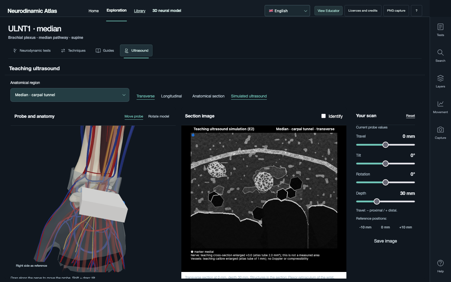 Educational ultrasound simulation of the median nerve beside the 3D model in ULNT1
